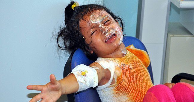 Konya’da üzerine çay dökülen çocuk yandı