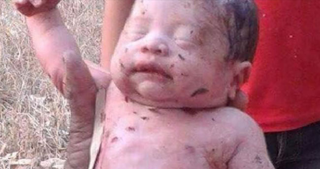 14 yerinden bıçaklanıp ormana atıldı ama…