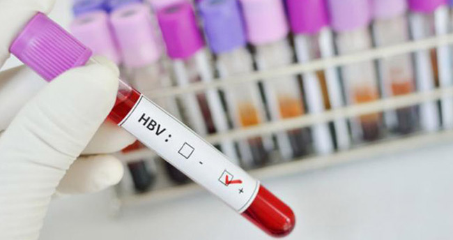 Kronik Hepatit B belirtileri nelerdir?