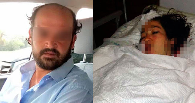 Doğum yapan eşini hastanede bıçakladı