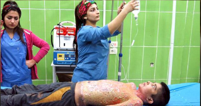 Terör örgütünün “kimyasal silah” yalanı ortaya çıktı! Kazan ve tişörtü alev almış