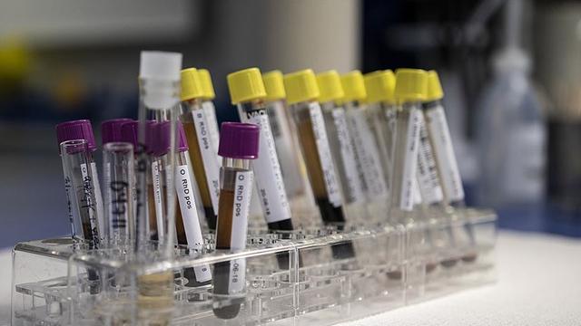 DSÖ: Avrupa ve ABD’de en az 169 ‘gizemli hepatit’ vakası var