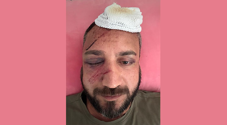‘İcraya verdiği eski sevgilisinin ailesi tarafından öldüresiye darp edildi’ iddiası