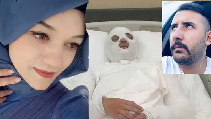 Konya’da eski nişanlısının yüzüne kimyasal madde atan sanığın cezası 16,5 yıla çıktı