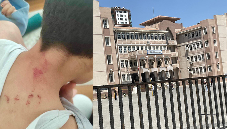 Şanlıurfa’da öğrencisini döven öğretmen tutuklandı