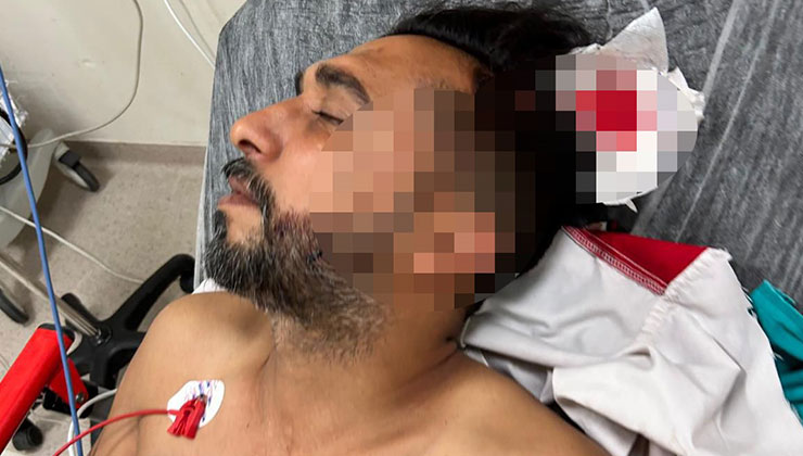 Adana’da döner ustası çalışırken başından yorgun mermiyle yaralandı
