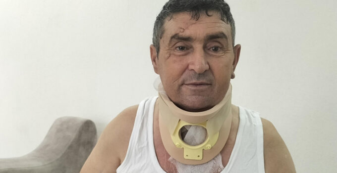 Manavgatlı çiftçi, kendisini yaralayan aslanın öldürülmesinin üzüntüsünü yaşıyor
