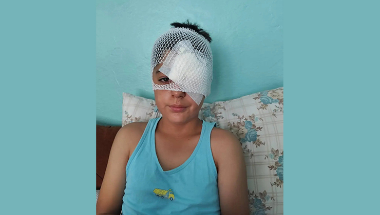 Şanlıurfa’da köpek saldırısından kaçan çocuğa otomobil çarptı