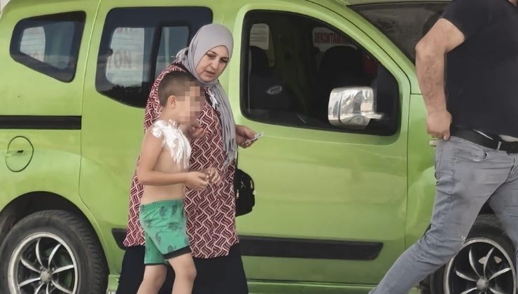 Üzerine parfüm sıkıp çakmak yakan çocuk yaralandı