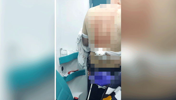 Abisini sokak ortasında silahla vurarak öldürdü