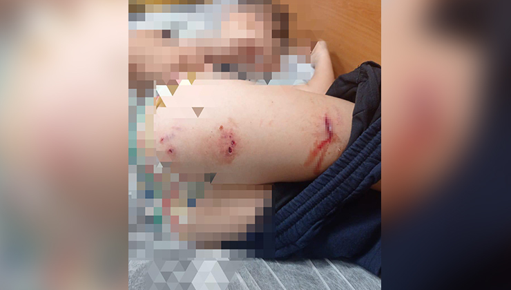 Sokak köpekleri faciaya neden oluyordu: Komşular yetişmeseydi parçalayacaklardı
