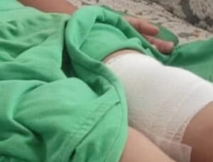 Bursa’da sahipsiz köpeğin saldırdığı çocuk bacağından yaralandı
