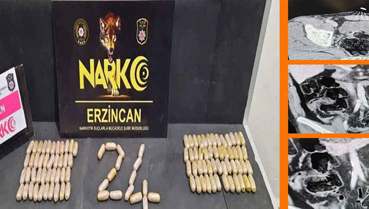 Erzincan polisinden çarpıcı operasyon: Midelerinde 109 ölüm kapsülü