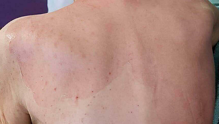 Huzurevinde ölümde, sanık doktor hakkında yakalama kararı