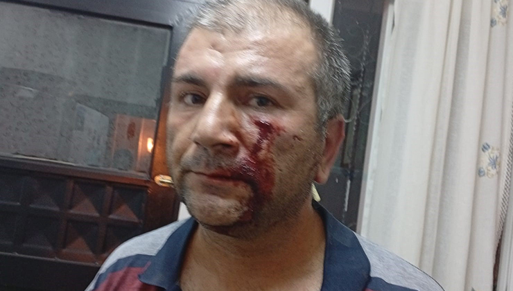 ‘Kenara çekilir misiniz’ diyerek uyardı, dayak yedi