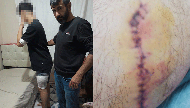 Konya’da okulda başlayan kavga okul dışına taştı, liseli çocuk bıçaklandı