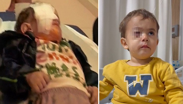 2 yaşındaki Alpaslan’ın görme yetisini kaybetmesine neden olan torpil, fırından alınmış