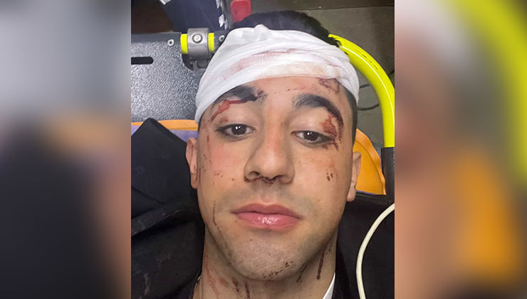 Kağıthane’de trafik tartışmasında taksici sopayla saldırdı: ‘Bagajdan sopayı çıkarıp kafama 10 defa vurdu’