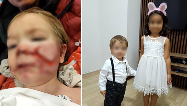 2 kardeşe saldıran pitbull ve sahibi yakalandı