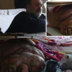 5 yıldır evden çıkamayan 300 kiloya ulaşan fil hastasının hayali; eşiyle kol kola caddede gezmek