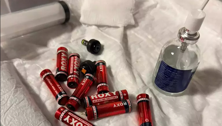 Cezaevindeki mahkumun midesinden çıkanlar şoke etti: 9 pil, 3 jilet