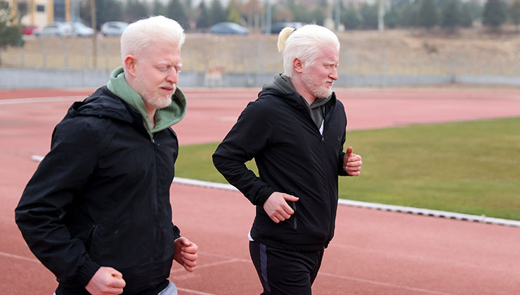 Konya’daki albinizmli antrenörlük öğrencisi arkadaşlar zorlukları dayanışmayla aşıyor