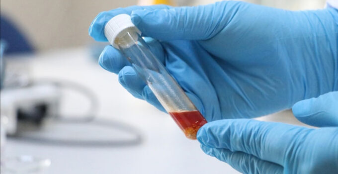 Tekirdağ’da üzüm atığından yüksek değerli tek hücre yağı üretildi