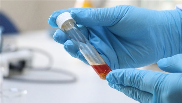 Tekirdağ’da üzüm atığından yüksek değerli tek hücre yağı üretildi