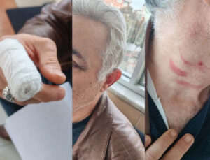 Konya’da akıl almaz olay! Müezzinden aile hekimine saldırı