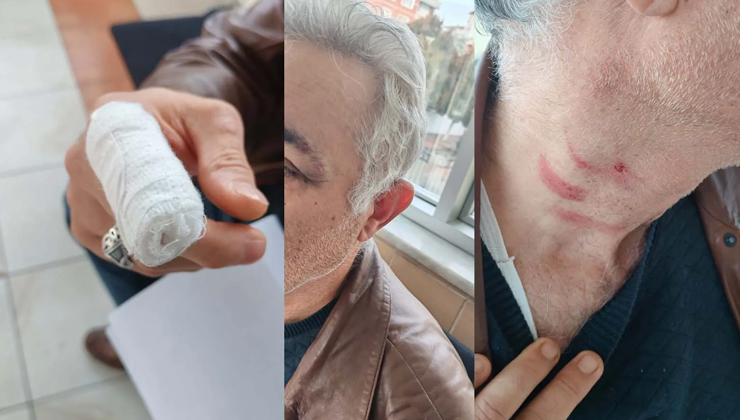 Konya’da akıl almaz olay! Müezzinden aile hekimine saldırı