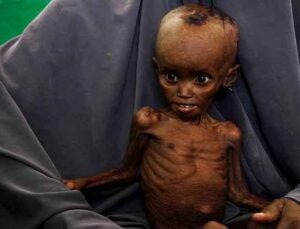 BM, Somali’de milyonlarca kişinin derinleşen açlık krizi riskiyle karşı karşıya olduğunu bildirdi