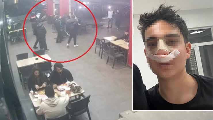 Hiç tanımadıkları genci “Neden bakıyorsun” diye darp edip burnunu kırdılar