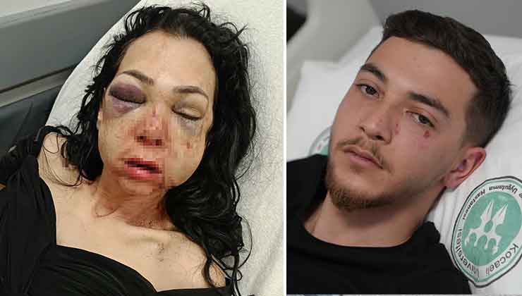 Oğlunun gözü önünde anneyi öldüresiye dövdüler: “‘Küfür etmeyin’ dedik diye bu hale geldim”