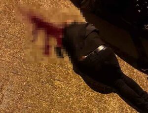 Sokakta yürürken tabanca ile başından vuruldu