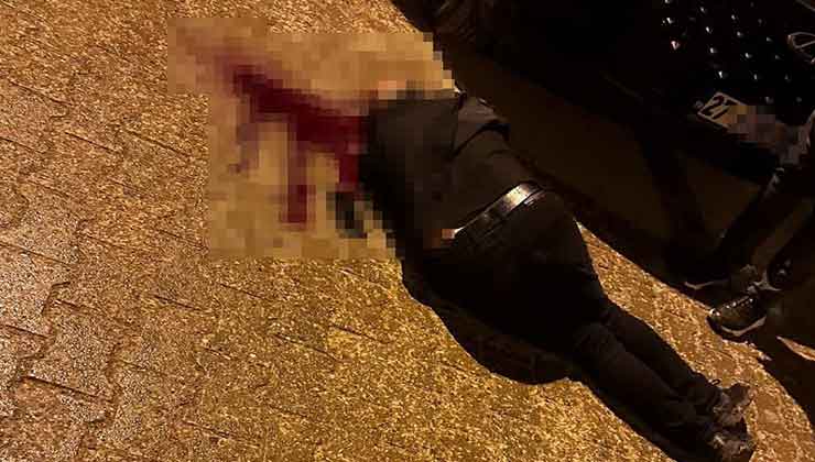 Sokakta yürürken tabanca ile başından vuruldu